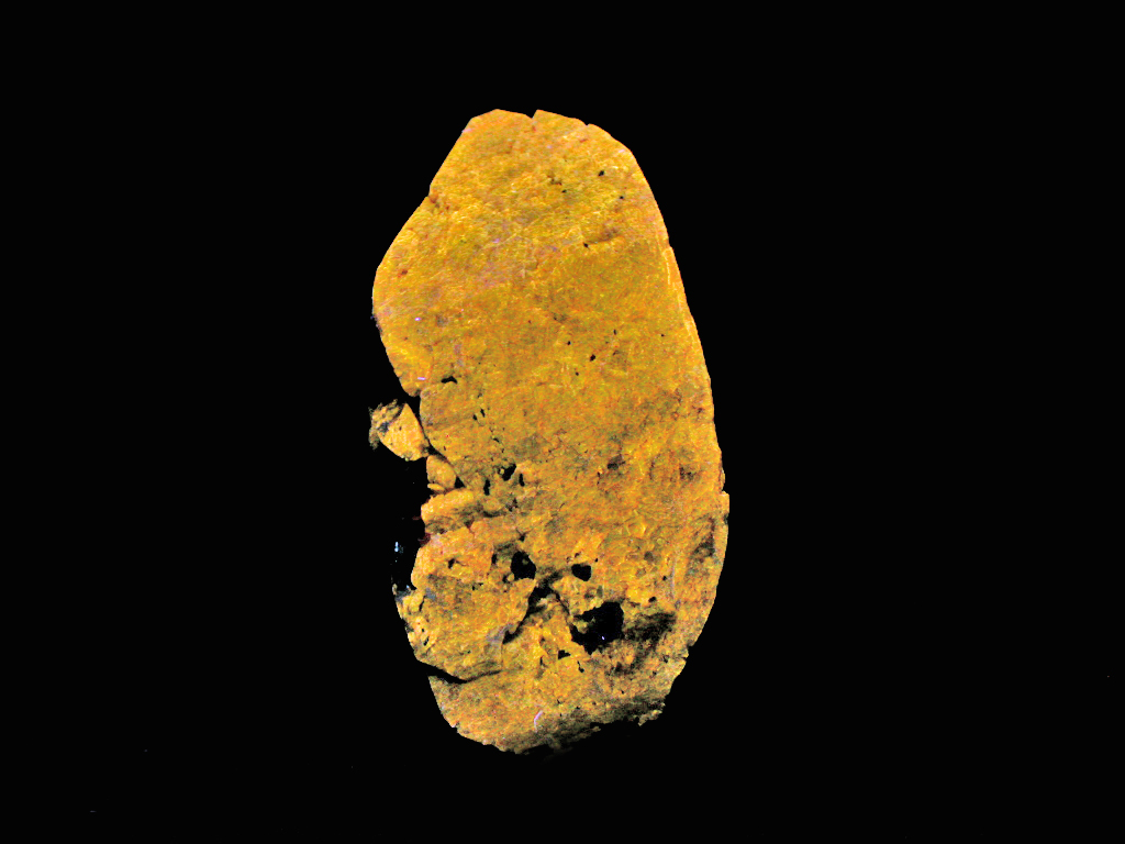 Zircon