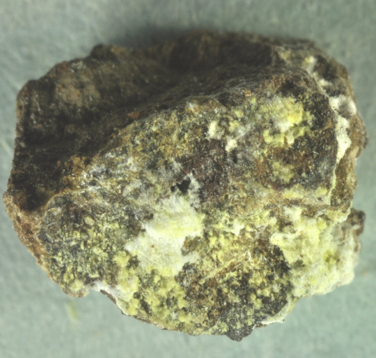 Apexite