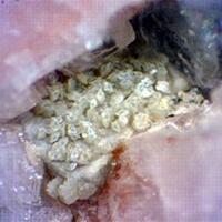 Hingganite-(Y) & Gadolinite-(Y)