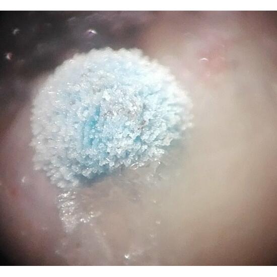 Ajoite & Shattuckite